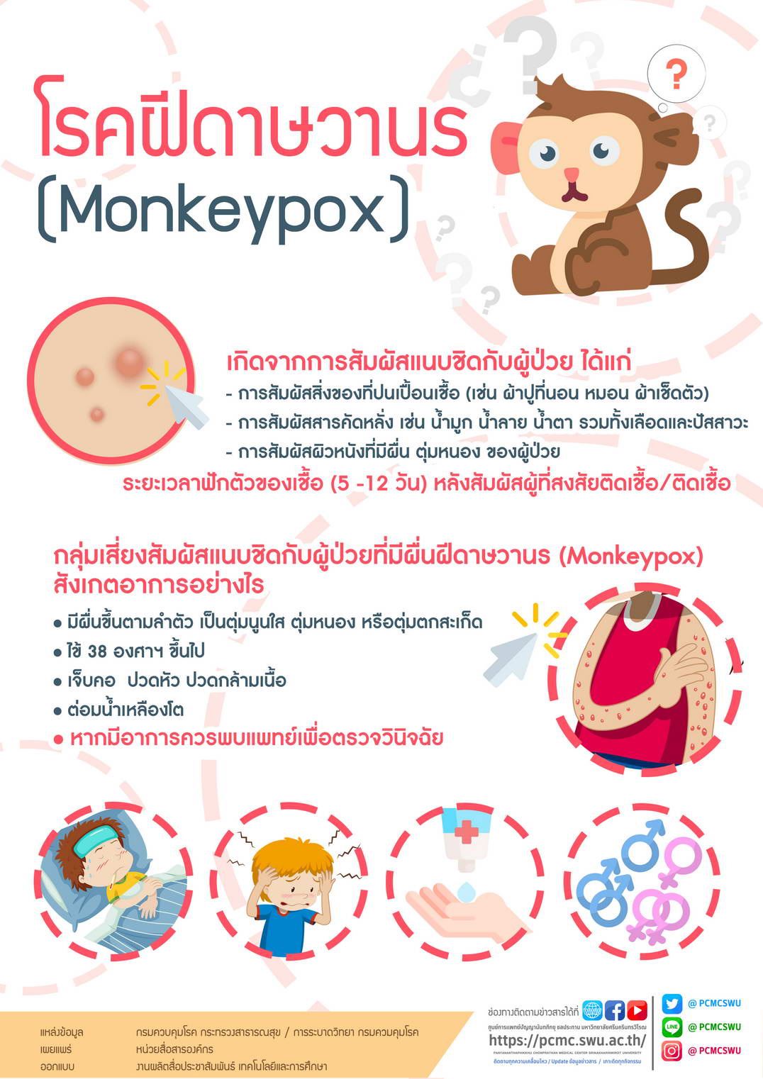 โรคฝีดาษวานร (Monkeypox)